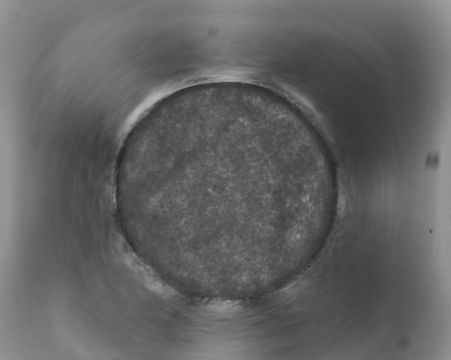 X0000111641174200908141400