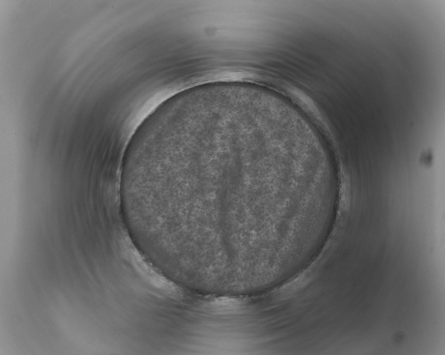 X0000111641178200908141400