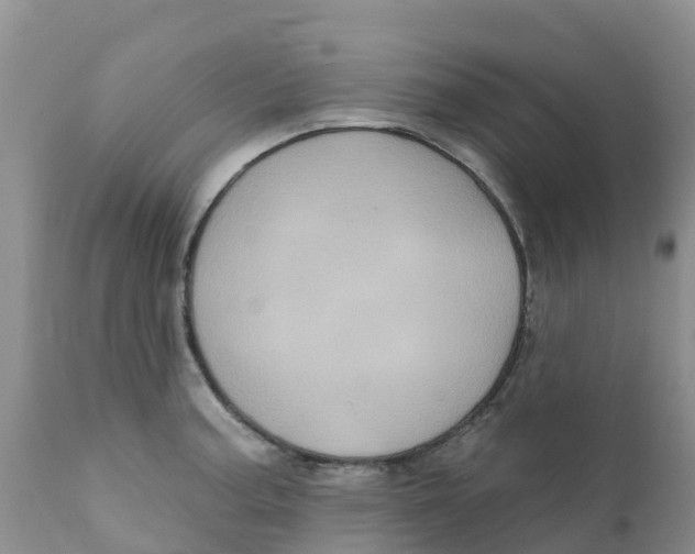 X0000111641187200908141400