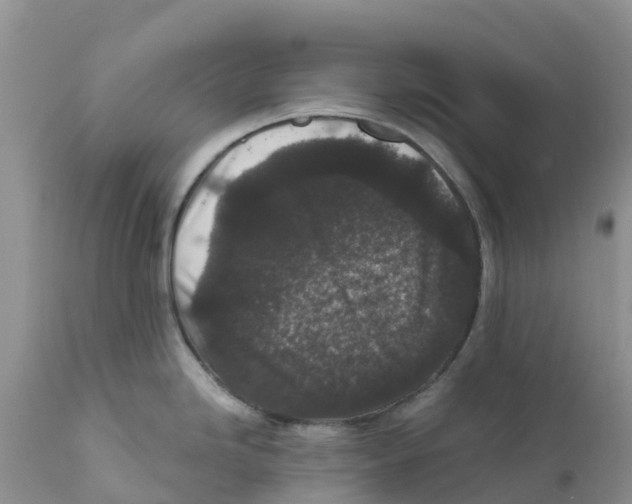X0000111641246200908141400