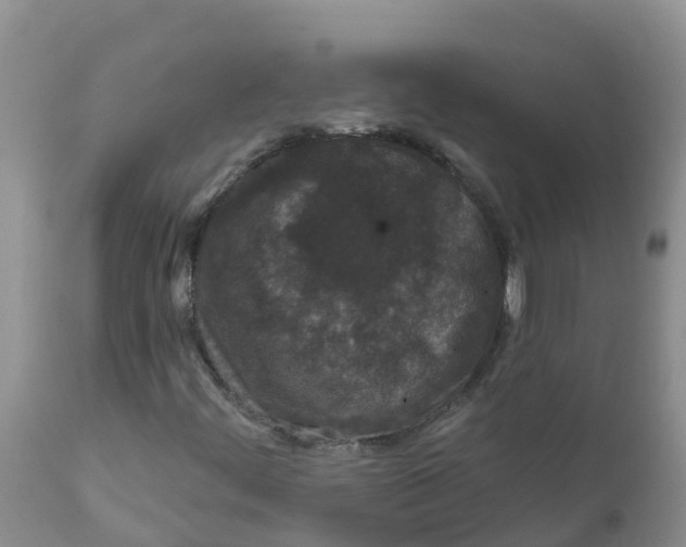 X0000111641444200908141356