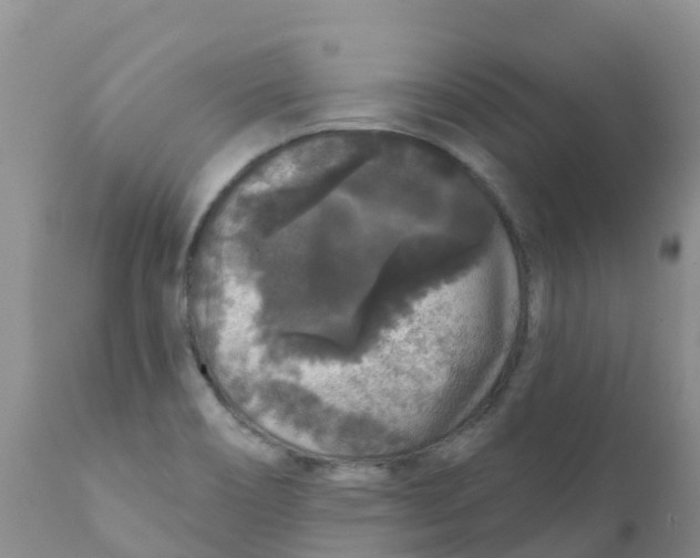 X0000111641466200908141355