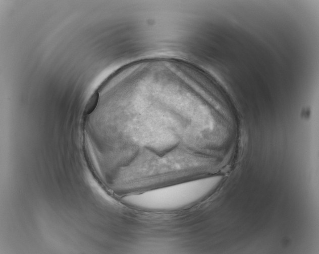 X0000111641468200908141355