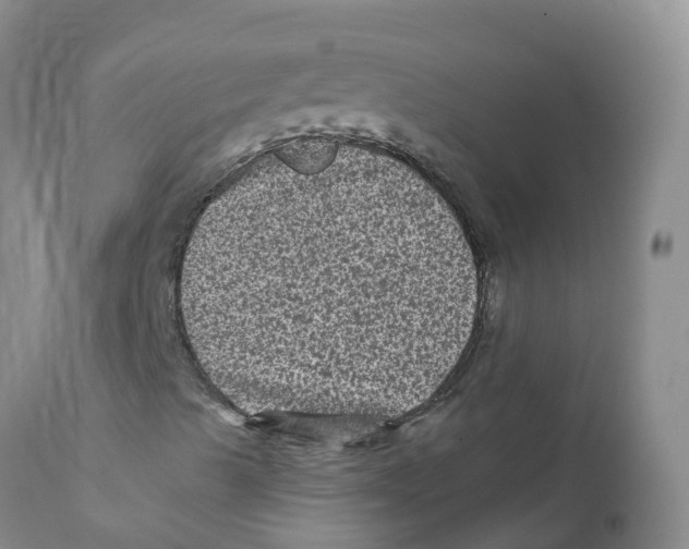 X0000111641489200908141354