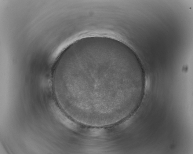 X0000111641498200908141355