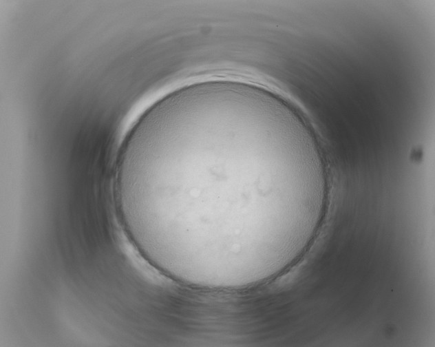 X0000111641514200908141355