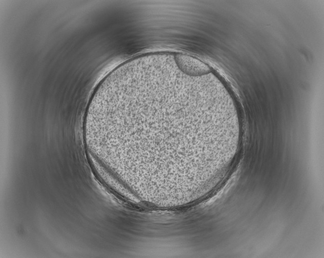 X0000111641137200908281151
