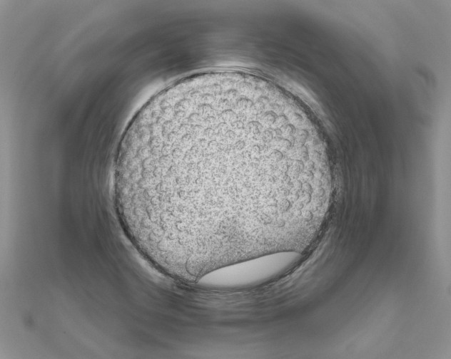 X0000111641420200908281147
