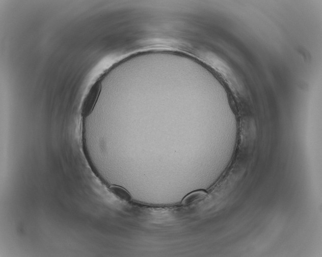 X0000111641472200908281146