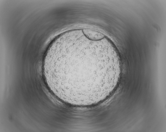 X0000111641499200908281145