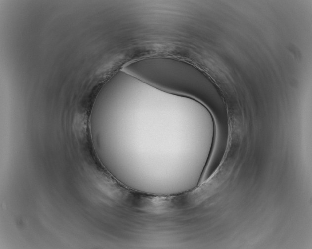X0000111650184200907171107