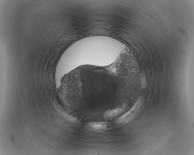 X0000111650187200907171107