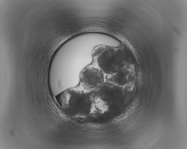 X0000111650529200907171101