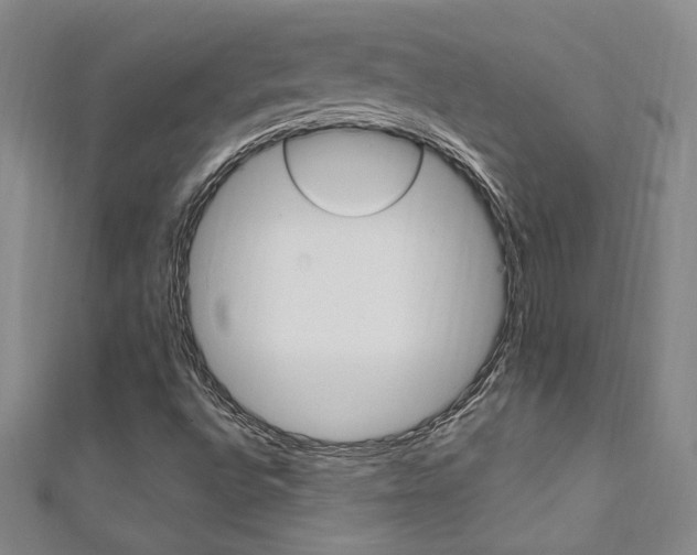 X0000111651496200907171048