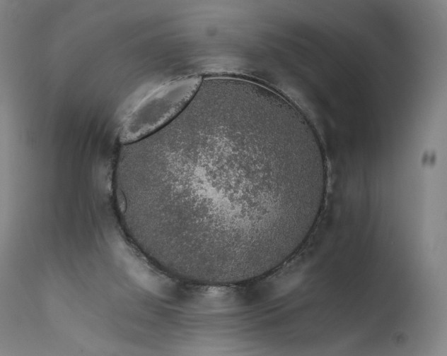 X0000111650060200907171555