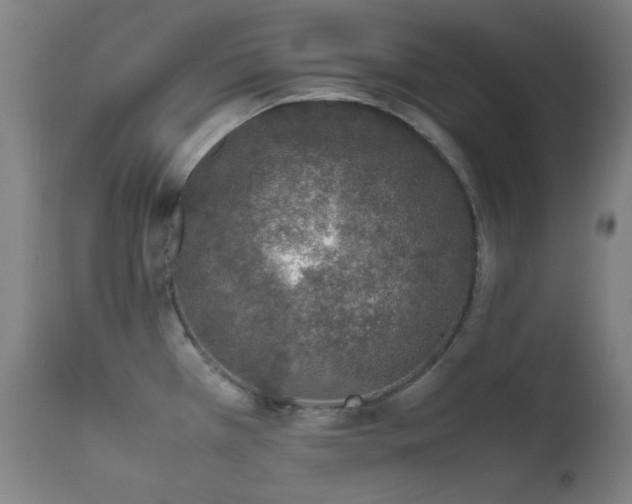 X0000111651385200907171534