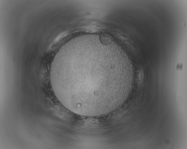 X0000111651446200907171532