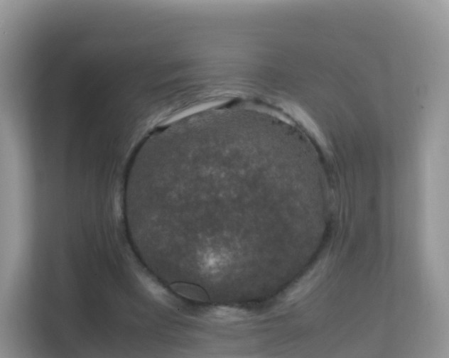 X0000111650393200907241136