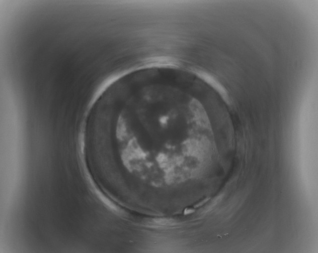 X0000111651383200907241122