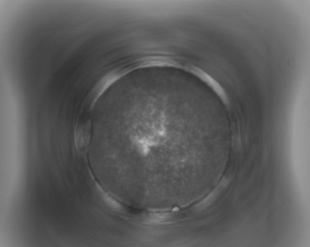 X0000111651385200907241122