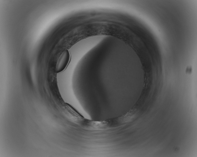 X0000111650239200908071416