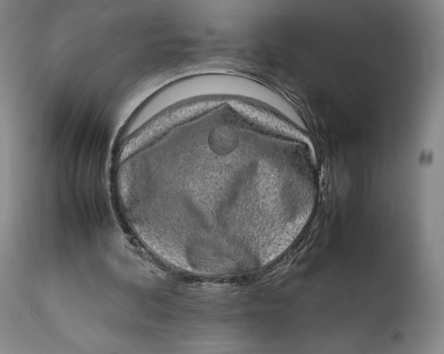 X0000111650292200908071415