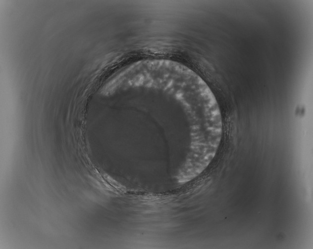 X0000111651009200908071402