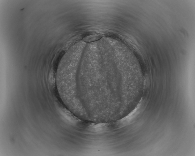 X0000111650186200908141300