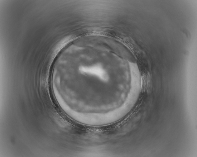X0000111650195200908141259