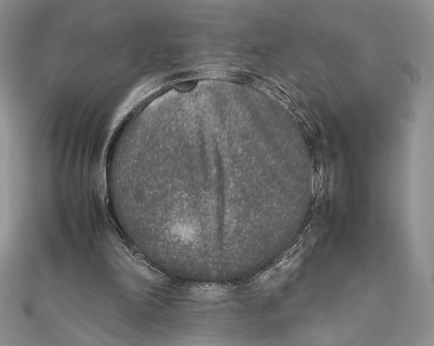 X0000111650198200908141259