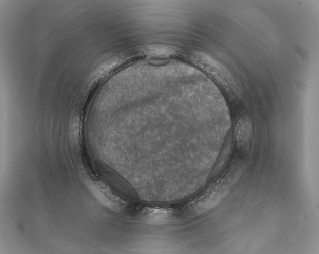 X0000111650352200908141257
