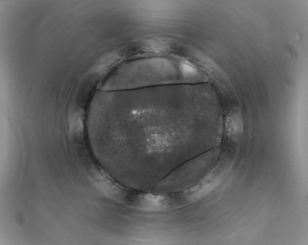 X0000111650570200908141254