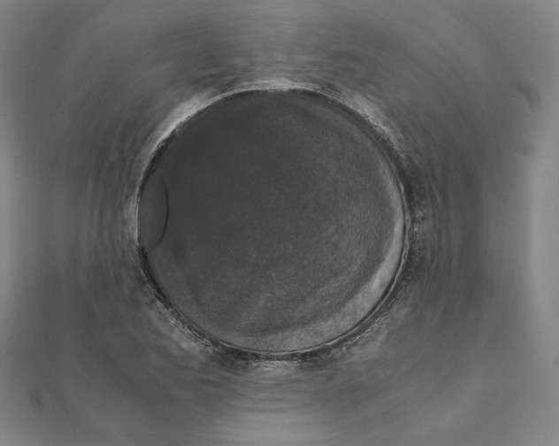 X0000111651173200908141245