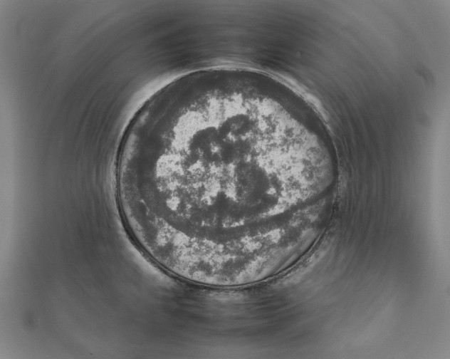 X0000111651239200908141244