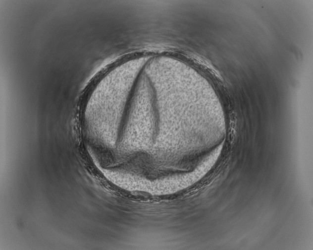X0000111651256200908141243