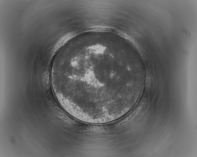 X0000111651362200908141242