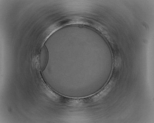 X0000111651369200908141242