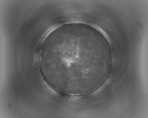 X0000111651385200908141242