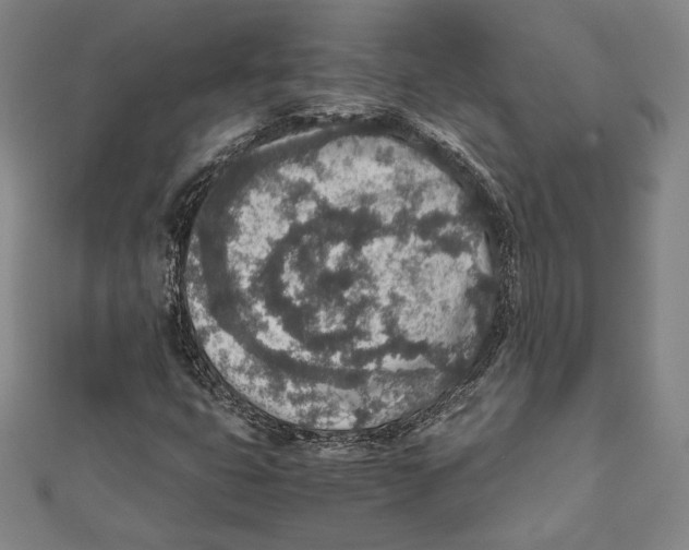 X0000111651399200908141241