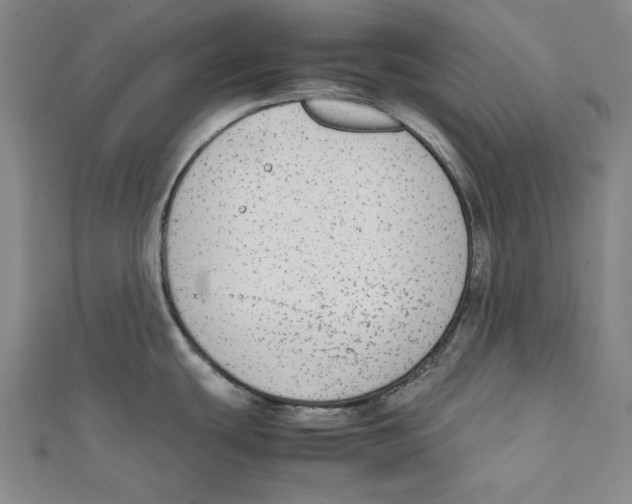 X0000111651439200908141241