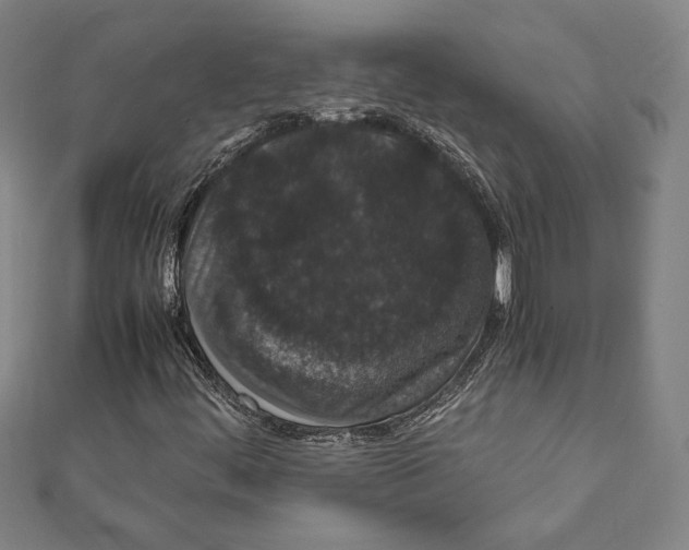 X0000111651444200908141241