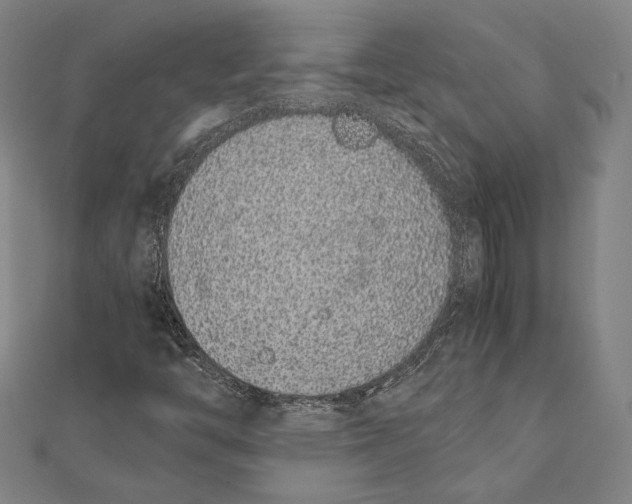 X0000111651446200908141241
