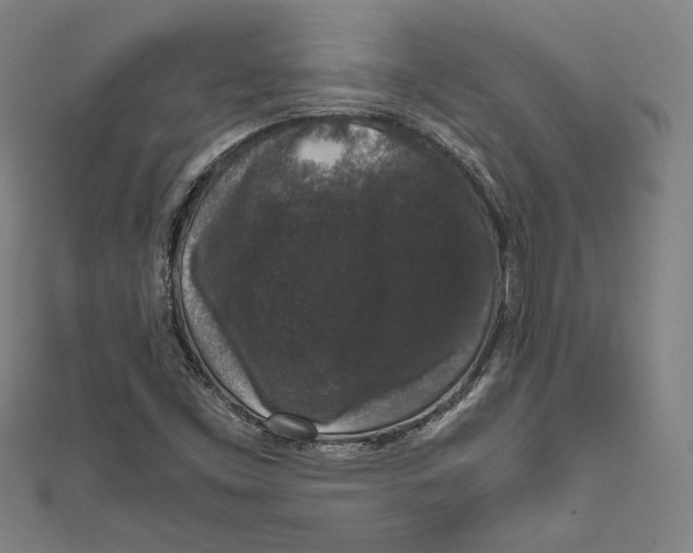 X0000111651453200908141241