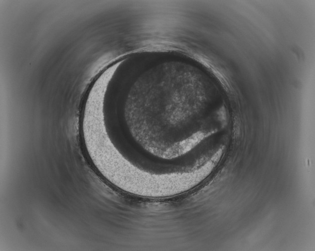 X0000111651459200908141241