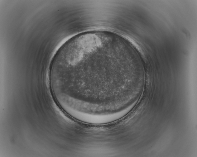 X0000111651468200908141240