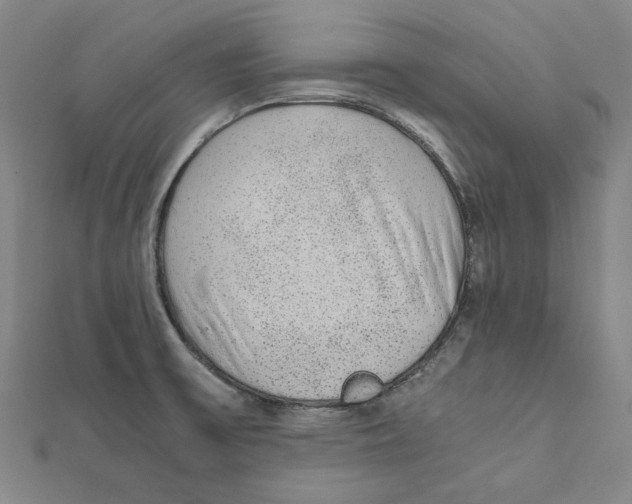 X0000111651475200908141240