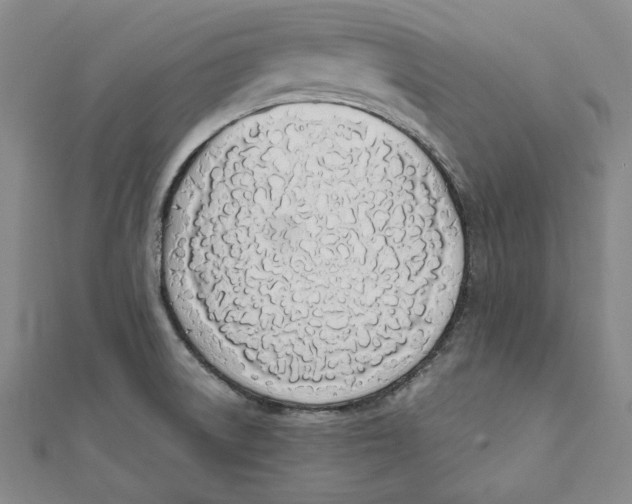 X0000111651522200908141240