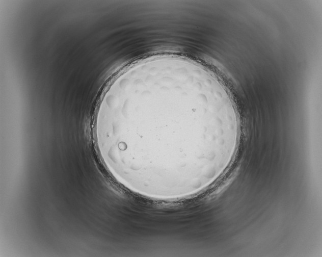 X0000111651113200908281044