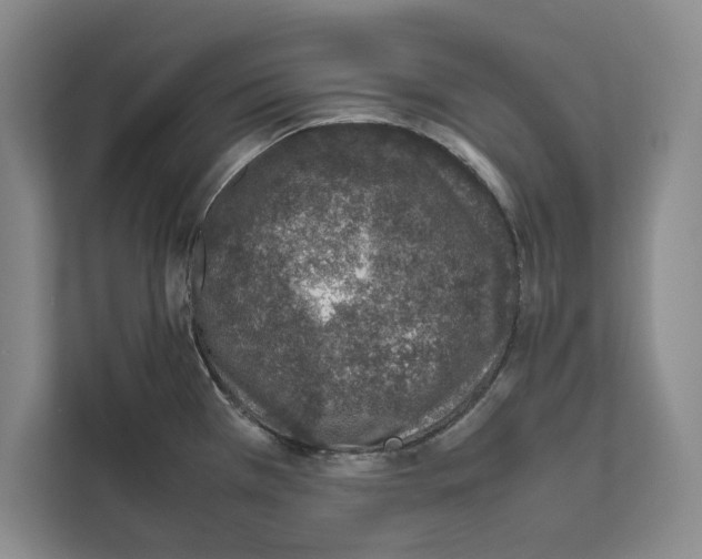 X0000111651385200908281040