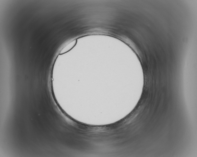 X0000111651387200908281040